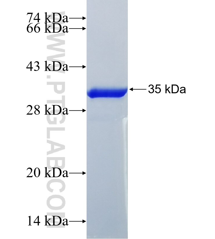 ERAF fusion protein Ag4588 SDS-PAGE
