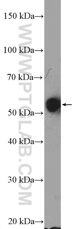 WB analysis of K-562 using 11478-1-AP