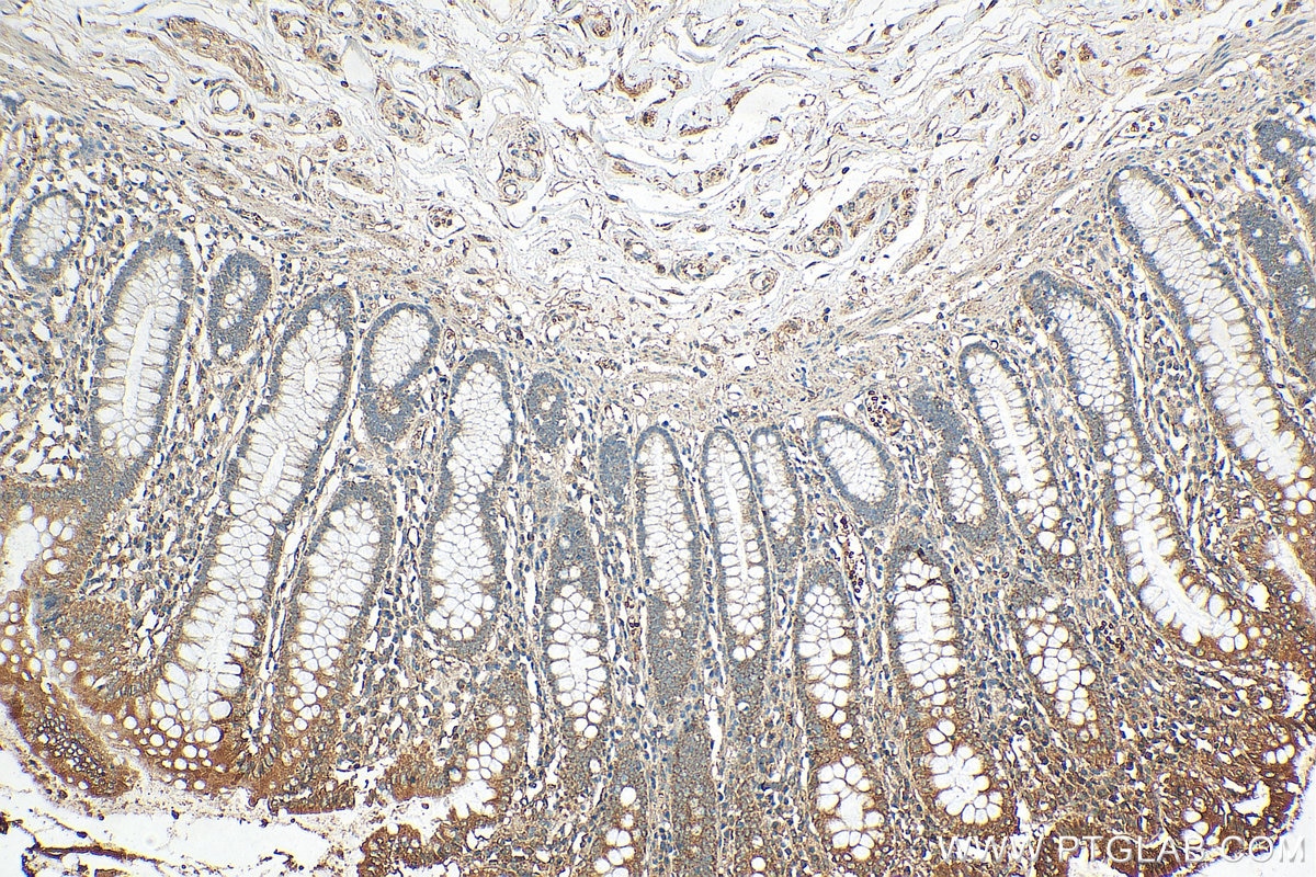 Immunohistochemistry (IHC) staining of human colon tissue using ERAL1 Polyclonal antibody (29465-1-AP)