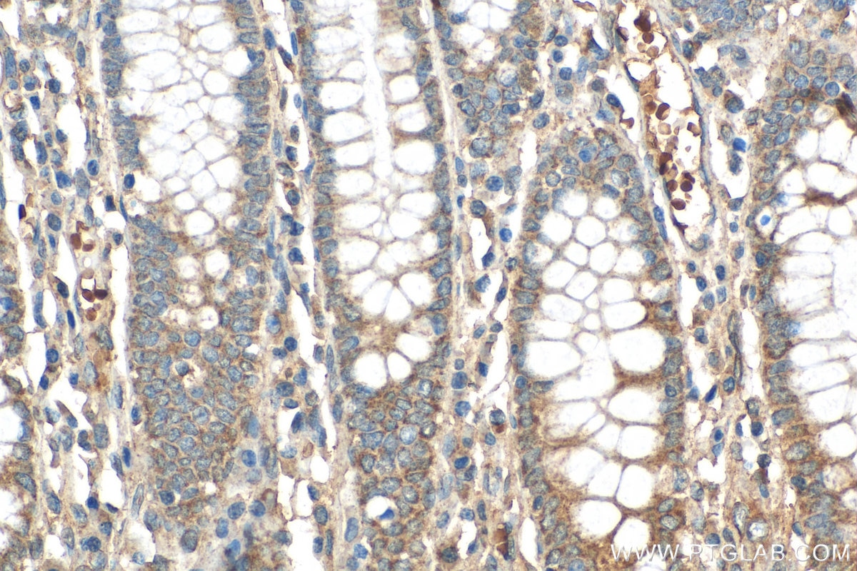 Immunohistochemistry (IHC) staining of human colon tissue using ERAL1 Polyclonal antibody (29465-1-AP)