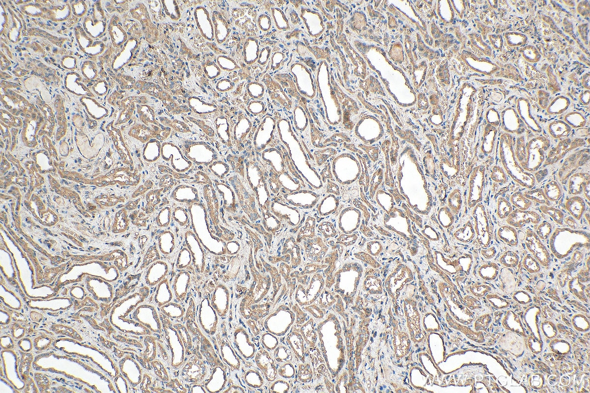 Immunohistochemistry (IHC) staining of human kidney tissue using ERAL1 Polyclonal antibody (29465-1-AP)