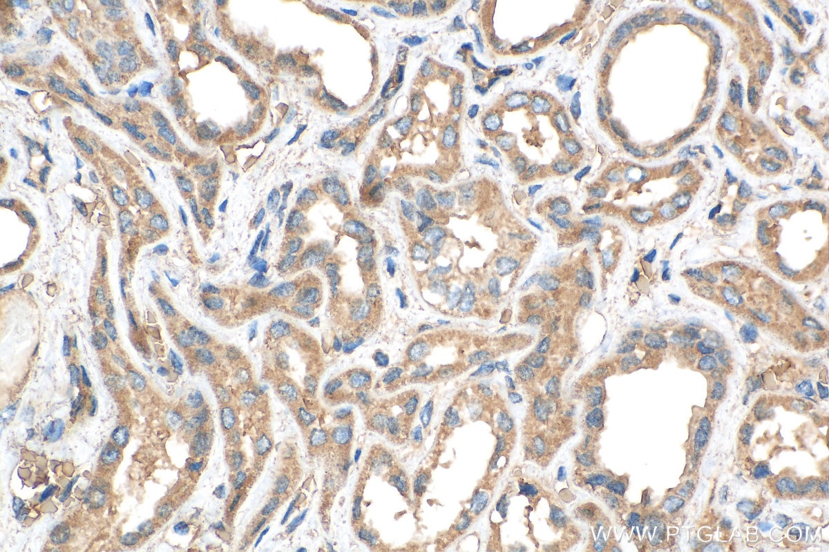 Immunohistochemistry (IHC) staining of human kidney tissue using ERAL1 Polyclonal antibody (29465-1-AP)