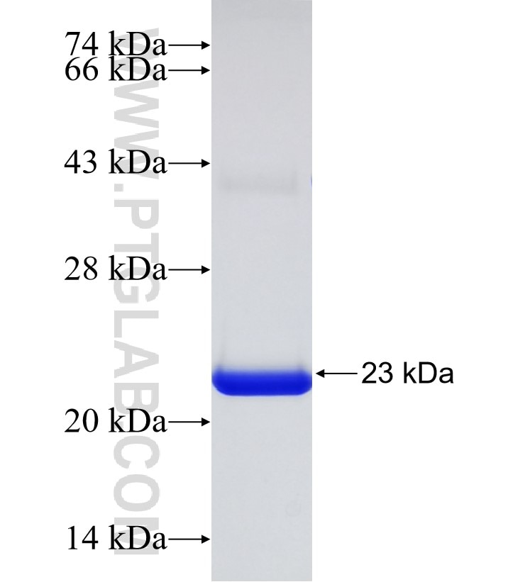 ERAL1 fusion protein Ag30735 SDS-PAGE ERAL1 fusion protein Ag30735 SDS-PAGE