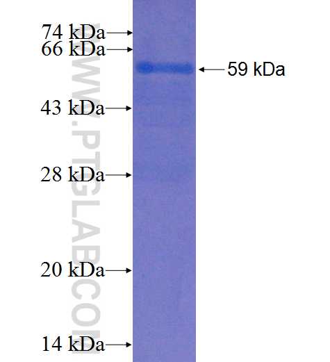 ERAL1 fusion protein Ag2019 SDS-PAGE