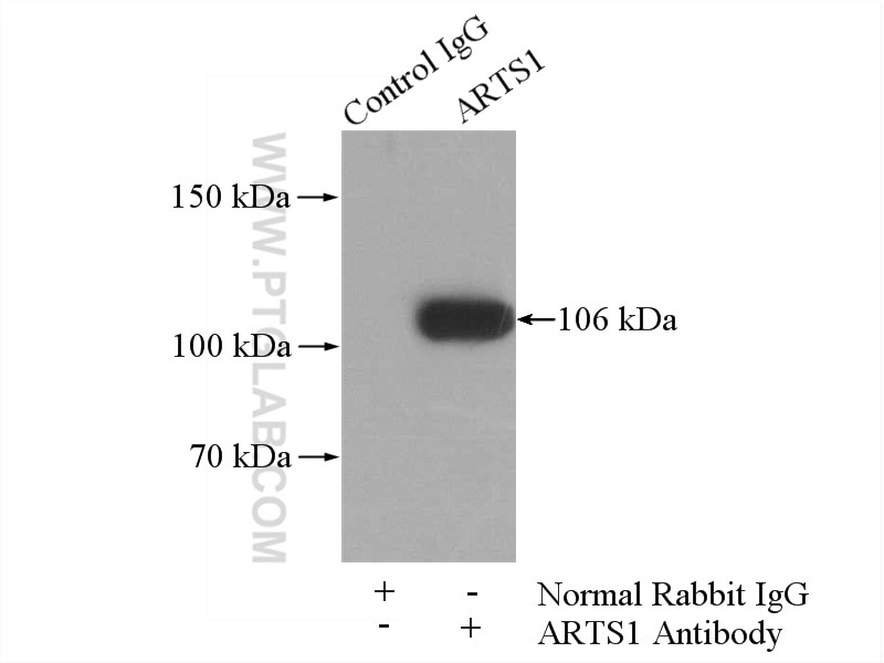 Immunoprecipitation (IP) experiment of Jurkat cells using ARTS1 Polyclonal antibody (13821-1-AP)