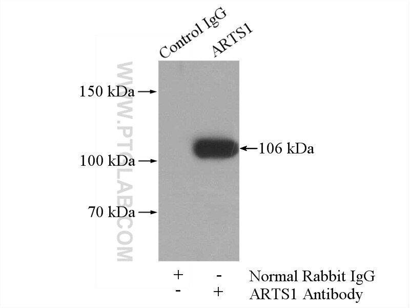 IP experiment of Jurkat using 13821-1-AP