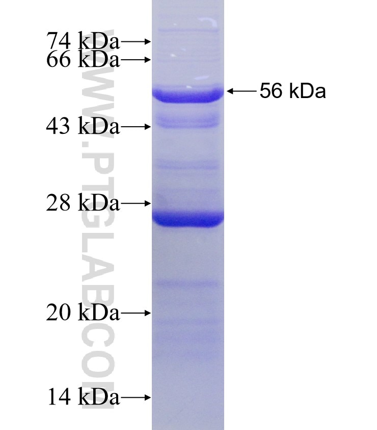 ERAP1 fusion protein Ag4918 SDS-PAGE
