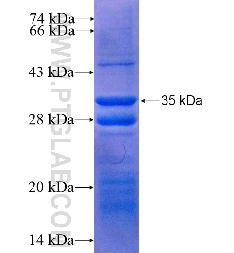 ERAP1 fusion protein Ag5155 SDS-PAGE