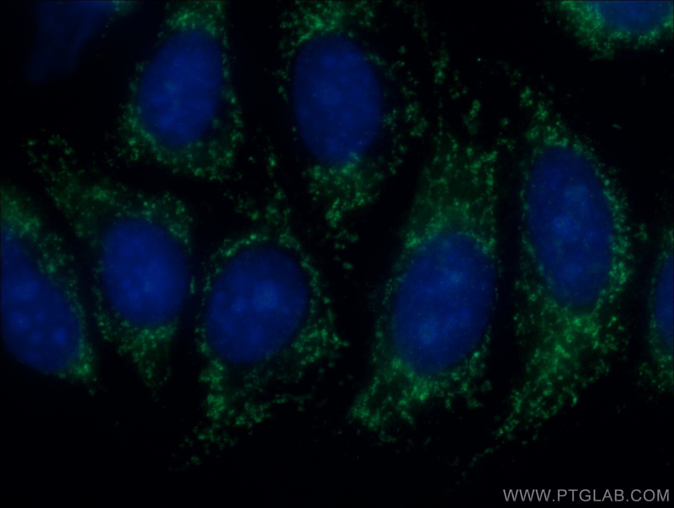 Immunofluorescence (IF) / fluorescent staining of HepG2 cells using ERAP2 Polyclonal antibody (14637-1-AP)