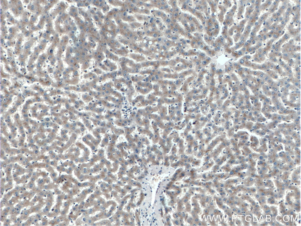 Immunohistochemistry (IHC) staining of human liver tissue using ERAP2 Polyclonal antibody (14637-1-AP)