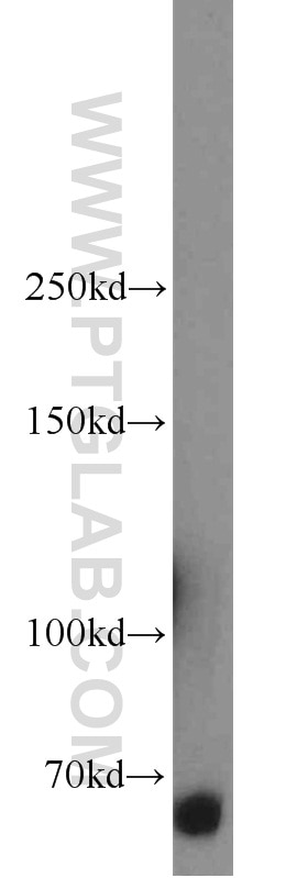 Western Blot (WB) analysis of K-562 cells using ERAP2 Polyclonal antibody (14637-1-AP)