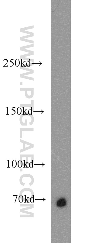 Western Blot (WB) analysis of mouse thymus tissue using ERAP2 Polyclonal antibody (14637-1-AP)