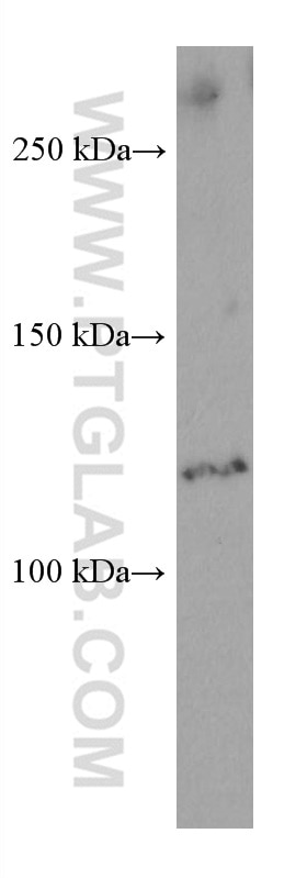 Western Blot (WB) analysis of HSC-T6 cells using ERAP2 Monoclonal antibody (67477-1-Ig)