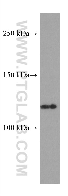 Western Blot (WB) analysis of HeLa cells using ERAP2 Monoclonal antibody (67477-1-Ig)