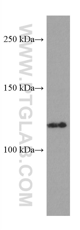 WB analysis of HeLa using 67477-1-Ig