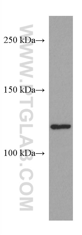 WB analysis of A549 using 67477-1-Ig