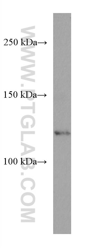 Western Blot (WB) analysis of HepG2 cells using ERAP2 Monoclonal antibody (67477-1-Ig)
