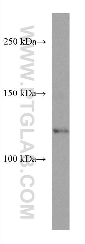 WB analysis of HepG2 using 67477-1-Ig