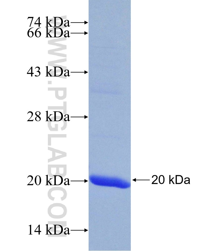 ERAP2 fusion protein Ag30061 SDS-PAGE
