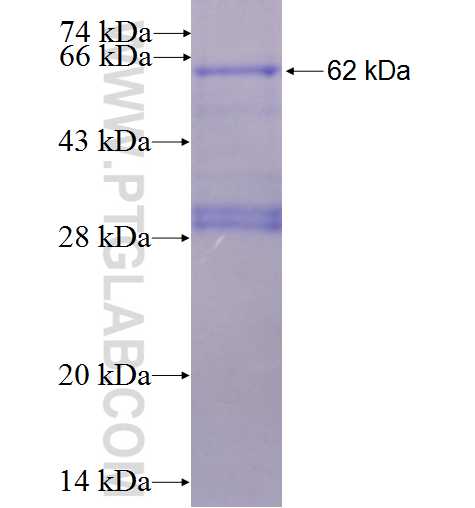 ERAP2 fusion protein Ag6216 SDS-PAGE