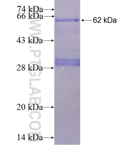 ERAP2 fusion protein Ag6216 SDS-PAGE