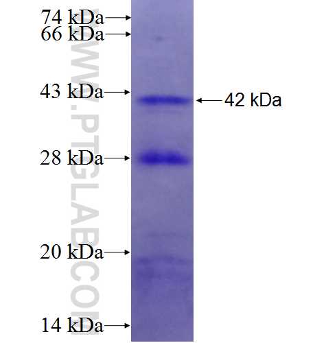 ERAP2 fusion protein Ag6351 SDS-PAGE