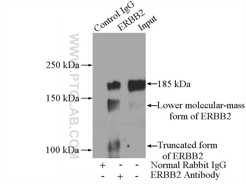 Immunoprecipitation (IP) experiment of SGC-7901 cells using HER2/ErbB2 Polyclonal antibody (18299-1-AP)