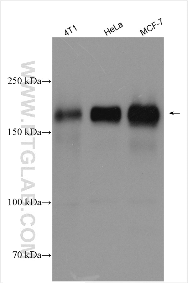 Western Blot (WB) analysis of various lysates using HER2/ErbB2 Polyclonal antibody (18299-1-AP)