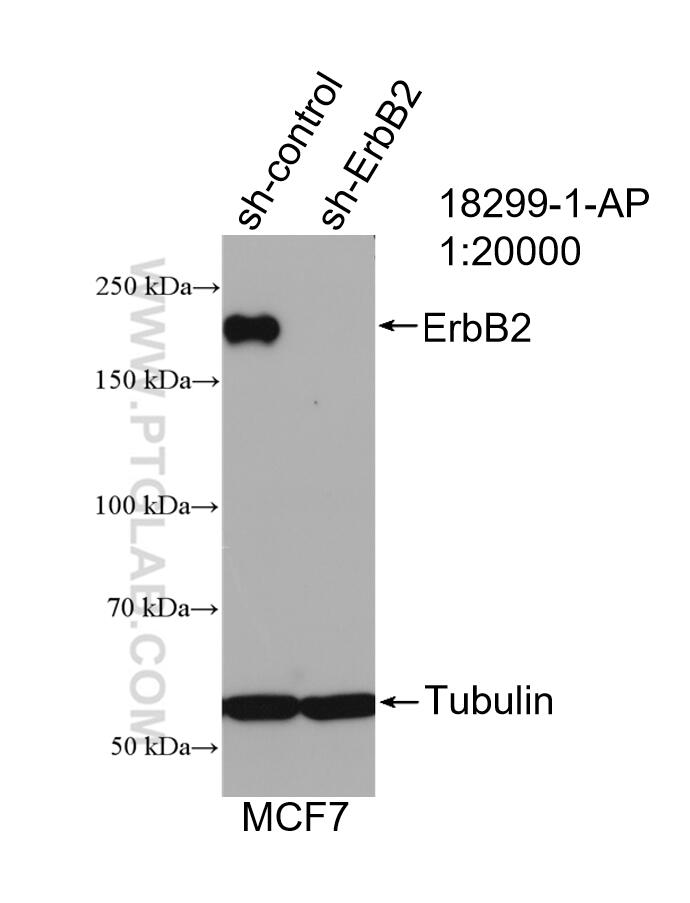 Western Blot (WB) analysis of MCF-7 cells using HER2/ErbB2 Polyclonal antibody (18299-1-AP)