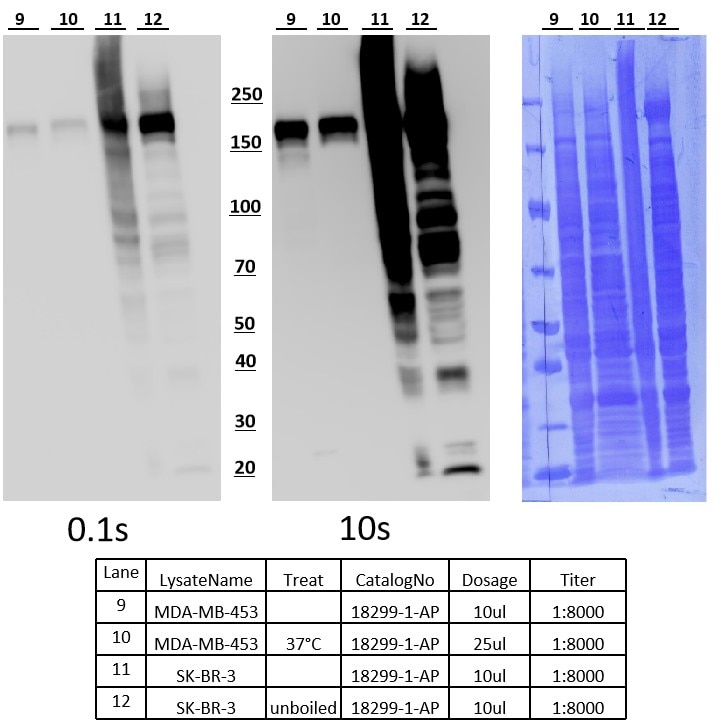 WB analysis using 18299-1-AP Western Blot (WB) analysis of various lysates using HER2/ErbB2 Polyclonal antibody (18299-1-AP)