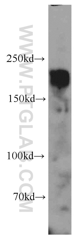 Western Blot (WB) analysis of SGC-7901 cells using HER2/ErbB2 Polyclonal antibody (18299-1-AP)