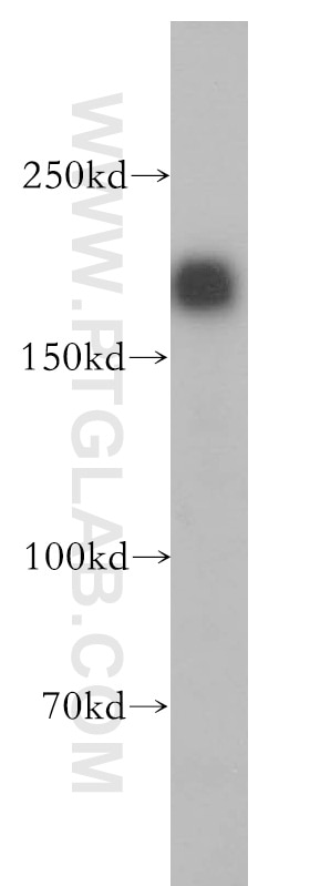 HER2/ErbB2 Polyclonal antibody