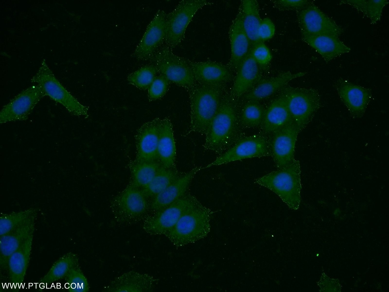 Immunofluorescence (IF) / fluorescent staining of HeLa cells using HER2/ErbB2 Polyclonal antibody (51105-1-AP)