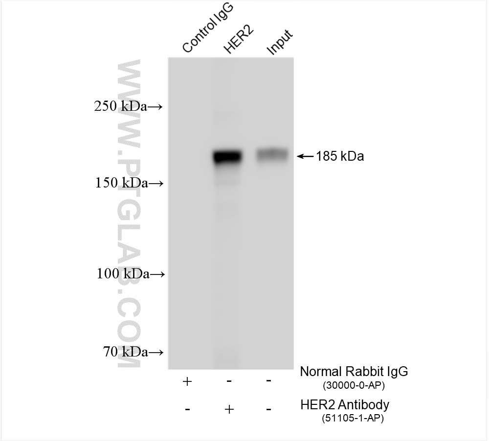 Immunoprecipitation (IP) experiment of SK-BR-3 cells using HER2/ErbB2 Polyclonal antibody (51105-1-AP)