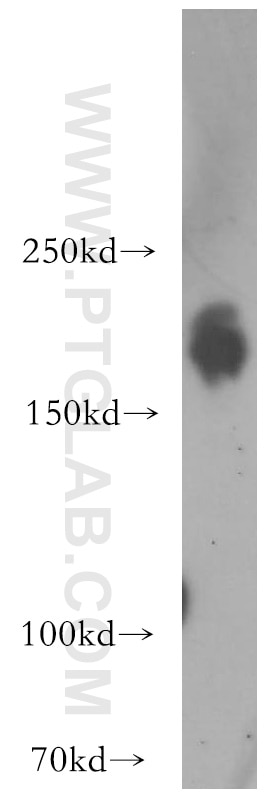 Western Blot (WB) analysis of MCF-7 cells using HER2/ErbB2 Polyclonal antibody (51105-1-AP)