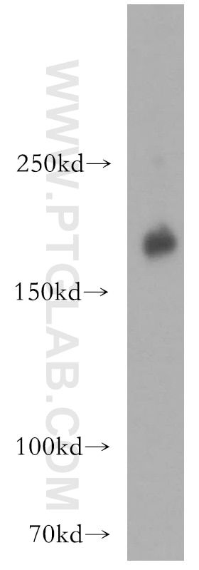 Western Blot (WB) analysis of HeLa cells using HER2/ErbB2 Polyclonal antibody (51105-1-AP)