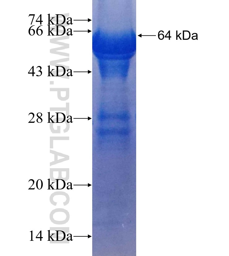 ERBB2 fusion protein Ag16463 SDS-PAGE