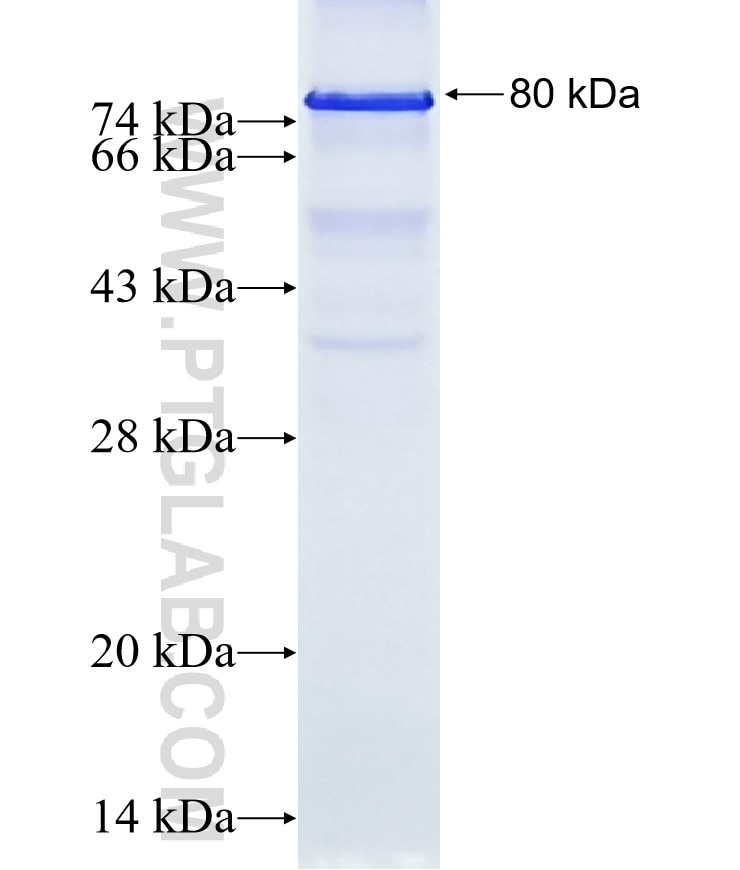 ERBB2 fusion protein Ag16463 SDS-PAGE