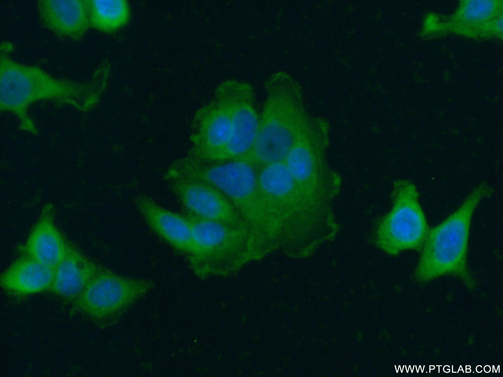 Immunofluorescence (IF) / fluorescent staining of MCF-7 cells using ERBB2IP Polyclonal antibody (22438-1-AP)