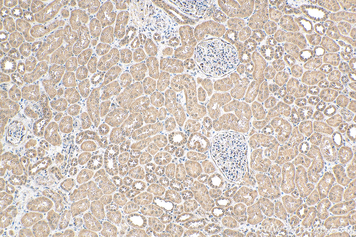 Immunohistochemistry (IHC) staining of human kidney tissue using ERBB2IP Polyclonal antibody (22438-1-AP)