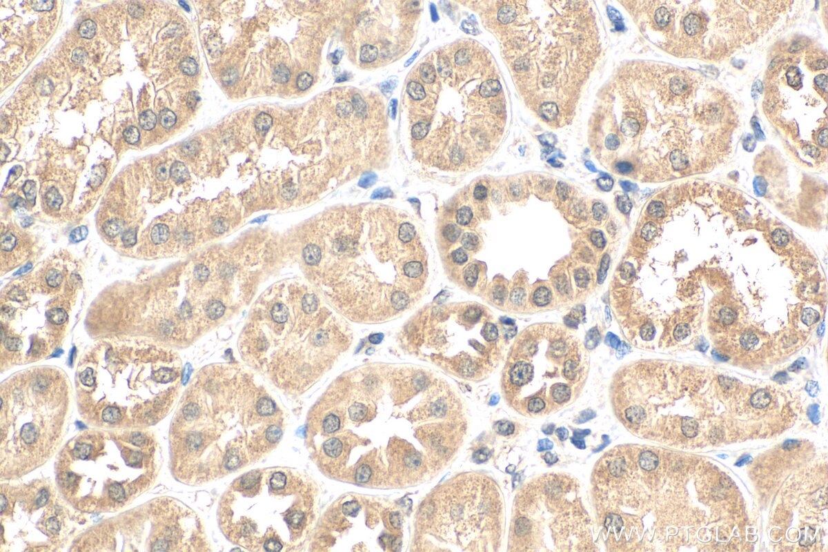 Immunohistochemistry (IHC) staining of human kidney tissue using ERBB2IP Polyclonal antibody (22438-1-AP)