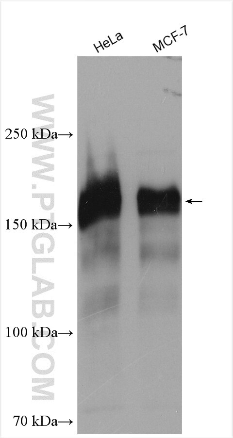 Western Blot (WB) analysis of various lysates using ERBB2IP Polyclonal antibody (22438-1-AP)