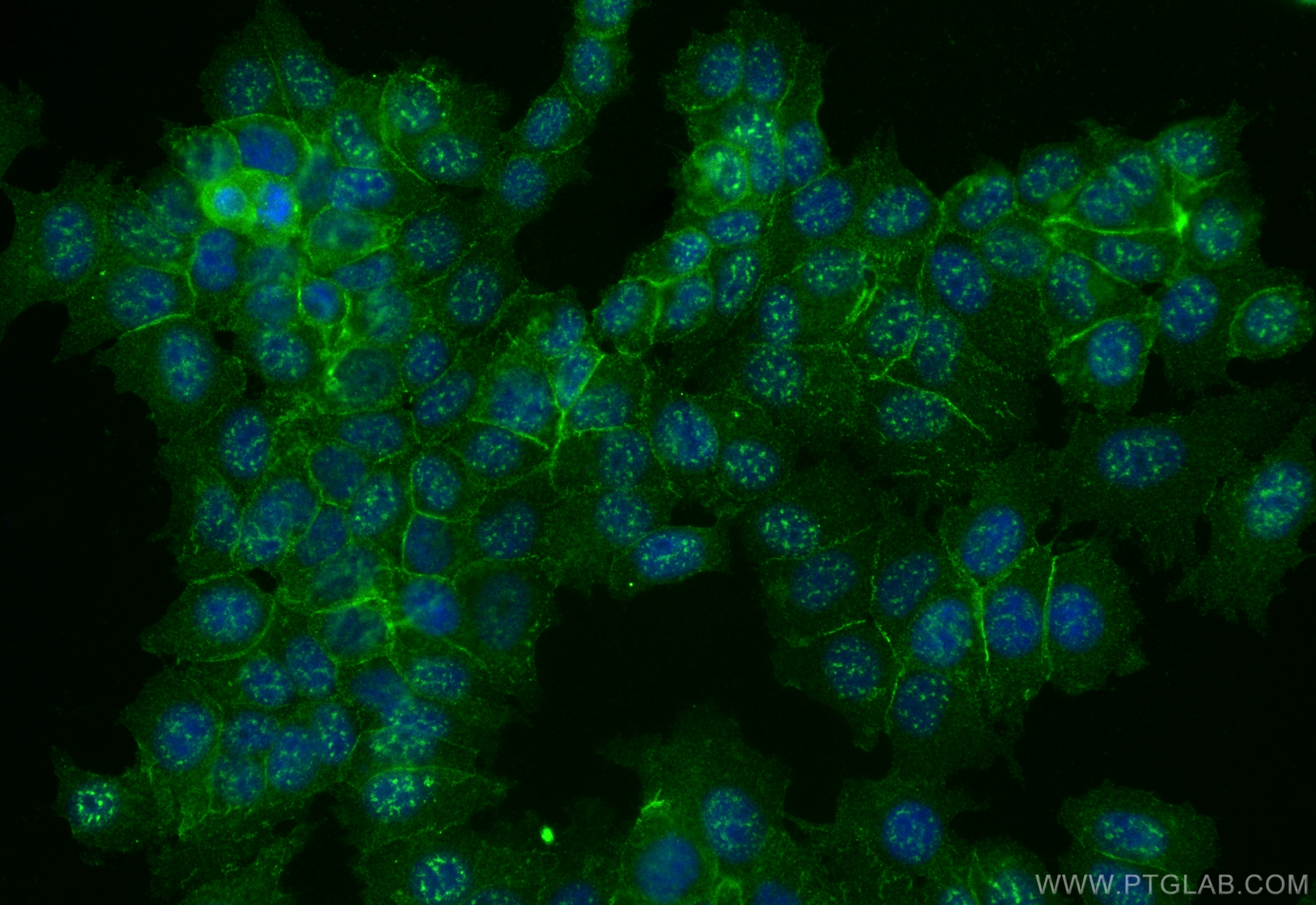 Immunofluorescence (IF) / fluorescent staining of MCF-7 cells using ERBB2IP Monoclonal antibody (68159-1-Ig)