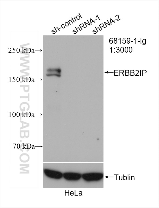 Western Blot (WB) analysis of HeLa cells using ERBB2IP Monoclonal antibody (68159-1-Ig)