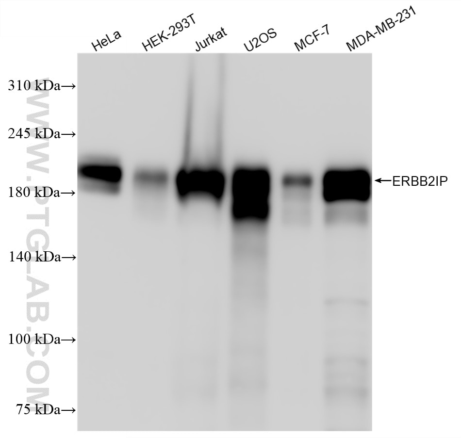 WB analysis using 87639-1-RR (same clone as 87639-1-PBS) Western Blot (WB) analysis of various lysates using ERBB2IP Recombinant monoclonal antibody (87639-1-RR)