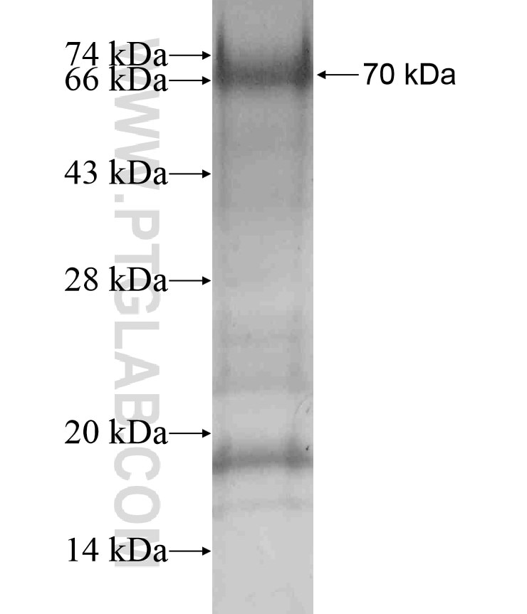 ERBB2IP fusion protein Ag18206 SDS-PAGE