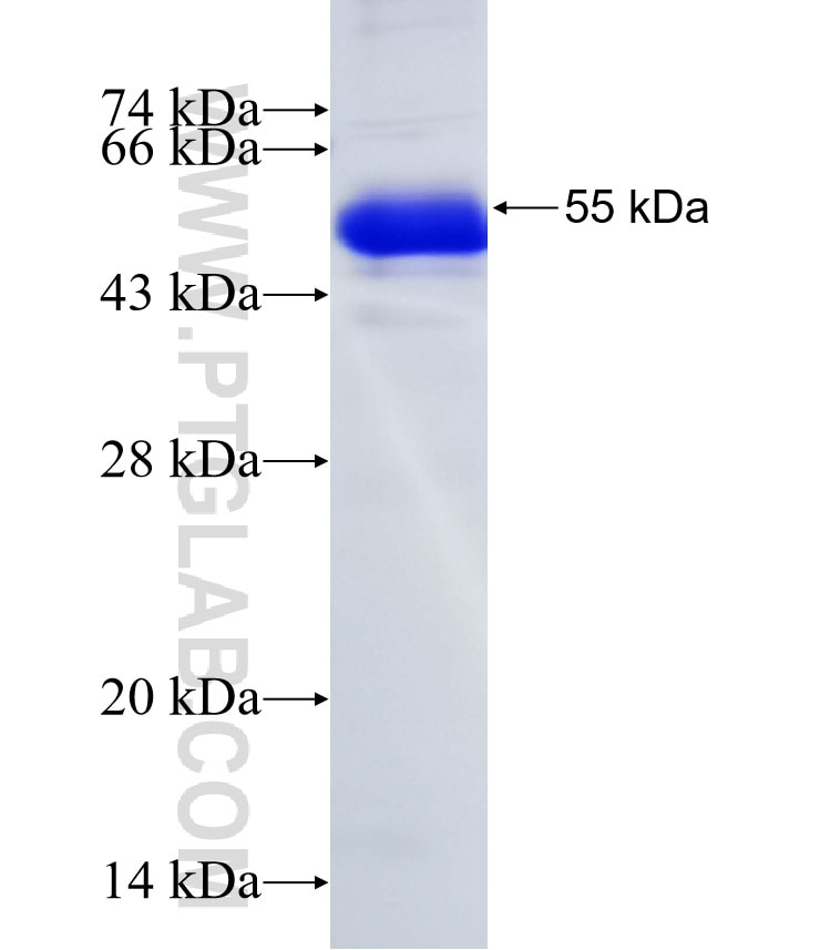 ERBB2IP fusion protein Ag18514 SDS-PAGE