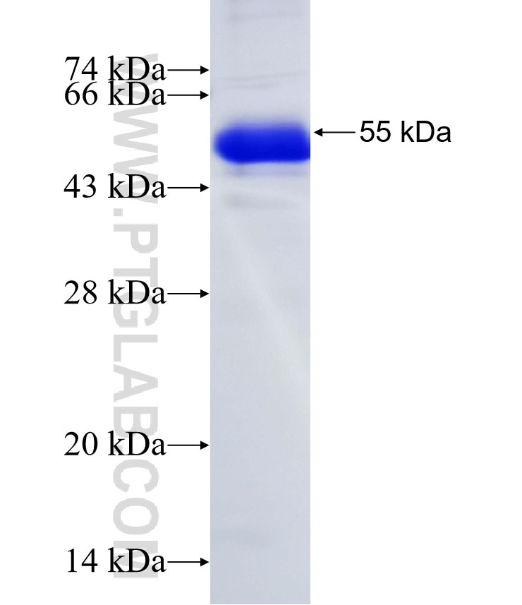 ERBB2IP fusion protein Ag18514 SDS-PAGE
