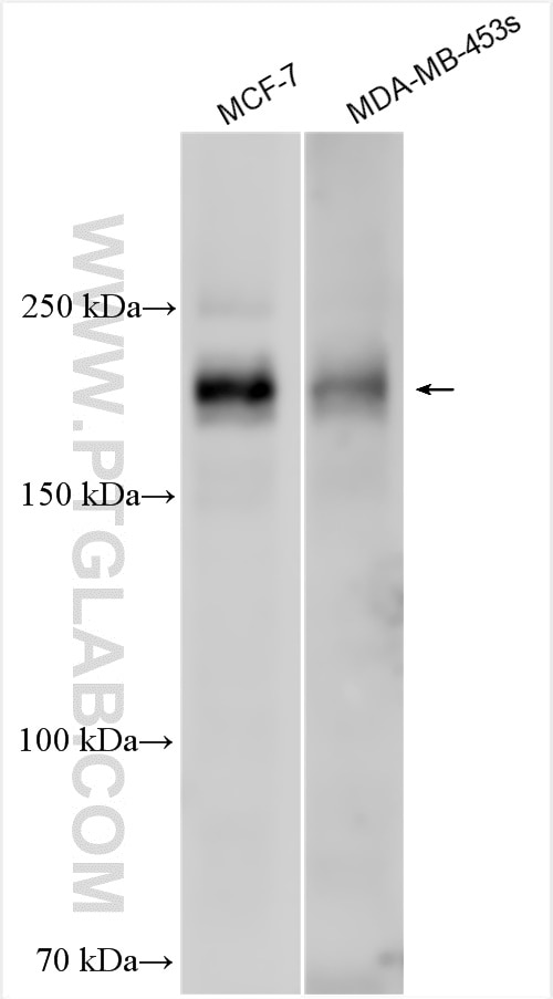 Western Blot (WB) analysis of various lysates using ERBB3 Polyclonal antibody (30452-1-AP)