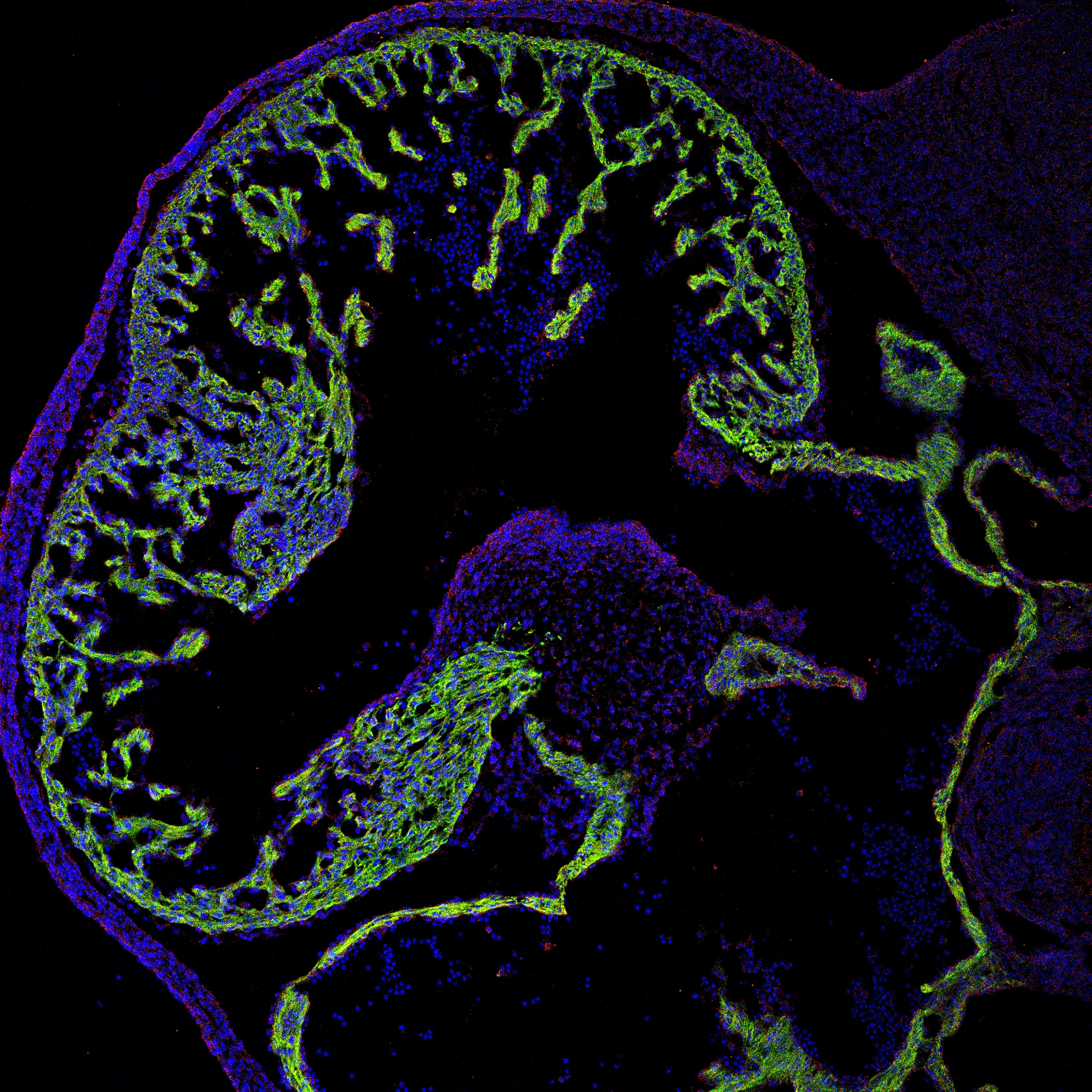 IF Staining of mouse heart using 19943-1-AP